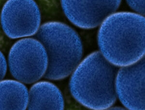 Picture of Stapylococcus